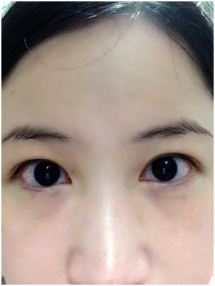 CosNature有機紅石榴緊緻拉提眼霜