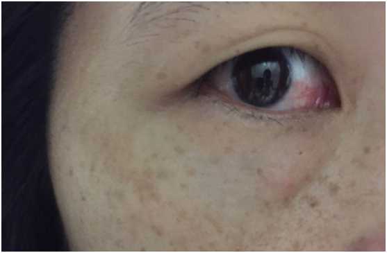 CosNature有機紅石榴緊緻拉提眼霜