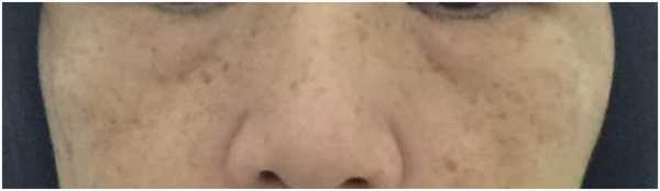 CosNature有機紅石榴緊緻拉提眼霜