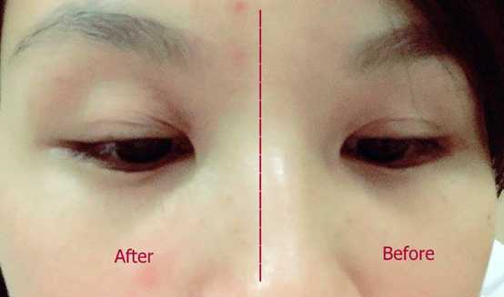 CosNature有機紅石榴緊緻拉提眼霜