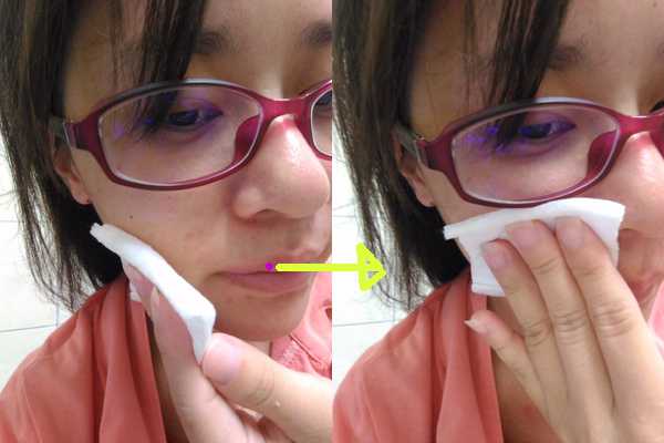 鑽美姬面皰粉刺油脂調理精華預防面皰粉刺