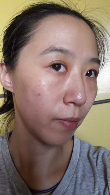 鑽美姬面皰粉刺油脂調理精華預防面皰粉刺