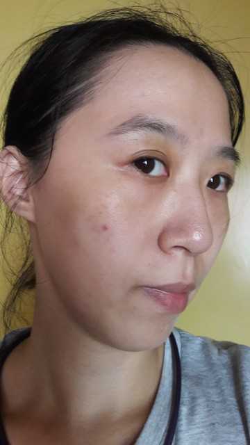 鑽美姬面皰粉刺油脂調理精華預防面皰粉刺