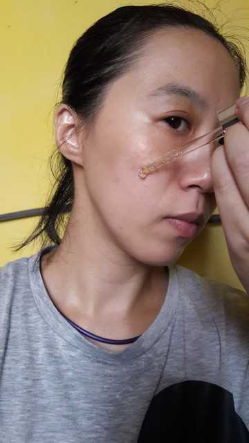 鑽美姬面皰粉刺油脂調理精華預防面皰粉刺