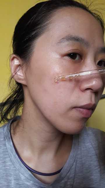 鑽美姬面皰粉刺油脂調理精華預防面皰粉刺