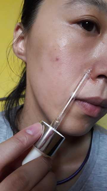 鑽美姬面皰粉刺油脂調理精華預防面皰粉刺