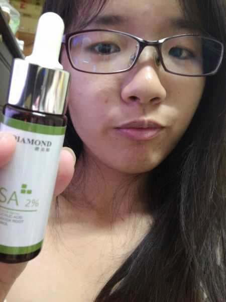 鑽美姬面皰粉刺油脂調理精華預防面皰粉刺