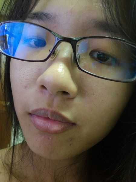 鑽美姬面皰粉刺油脂調理精華預防面皰粉刺