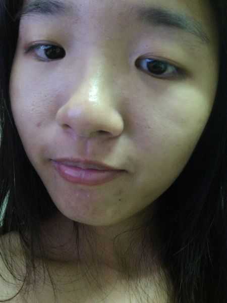 鑽美姬面皰粉刺油脂調理精華預防面皰粉刺