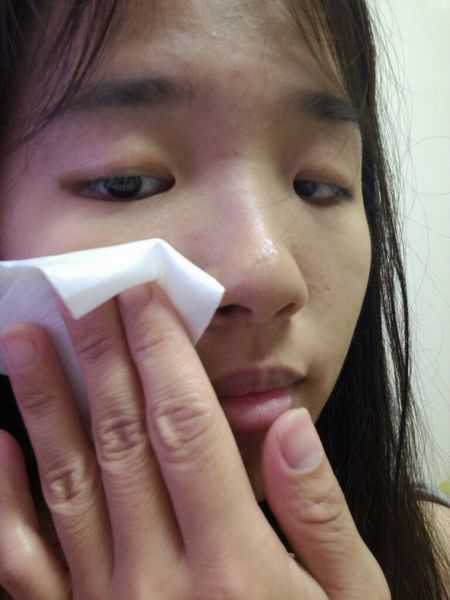 鑽美姬面皰粉刺油脂調理精華預防面皰粉刺