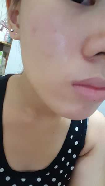 鑽美姬面皰粉刺油脂調理精華