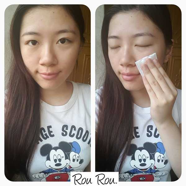 鑽美姬面皰粉刺油脂調理精華預防面皰粉刺