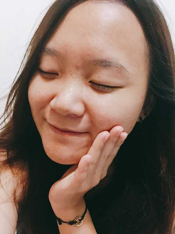 鑽美姬面皰粉刺油脂調理精華預防面皰粉刺