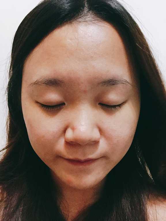 鑽美姬面皰粉刺油脂調理精華預防面皰粉刺