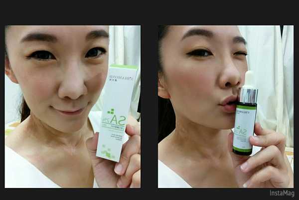 鑽美姬面皰粉刺油脂調理精華預防面皰粉刺