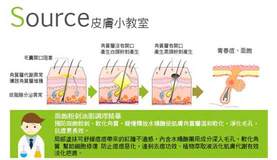 鑽美姬面皰粉刺油脂調理精華預防面皰粉刺