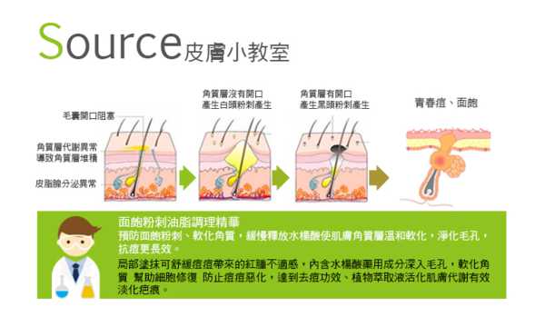 鑽美姬面皰粉刺油脂調理精華預防面皰粉刺