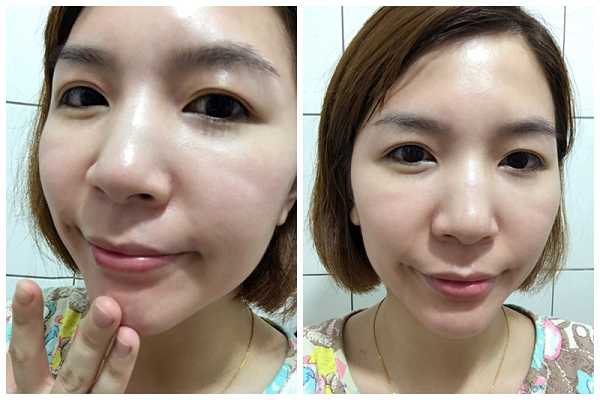 鑽美姬面皰粉刺油脂調理精華預防面皰粉刺