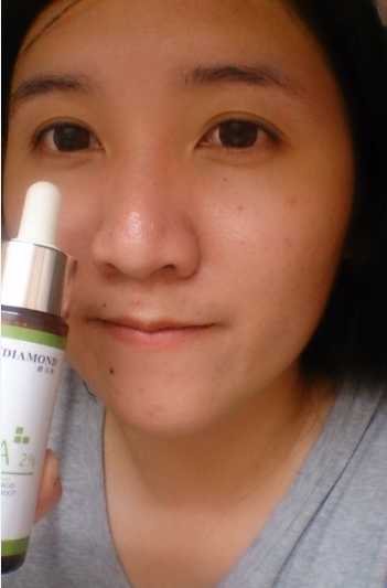 鑽美姬面皰粉刺油脂調理精華預防面皰粉刺