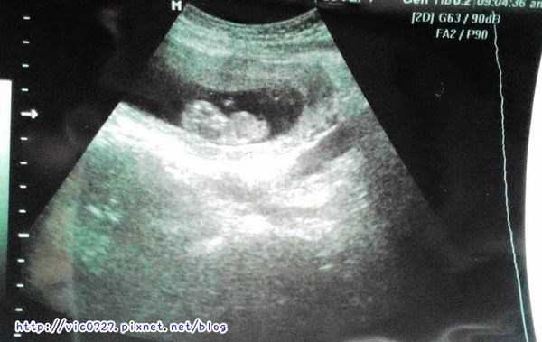 澳綠康倍SOUTHERNATURE媽咪魚油膠囊食品