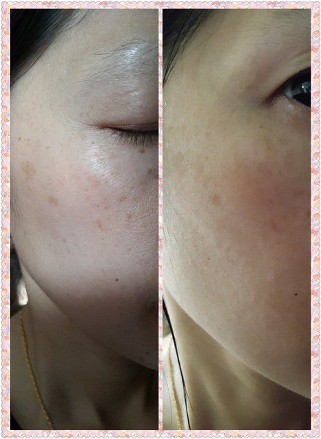 朵璽XIN NI SUNG激光瞬效美白精華