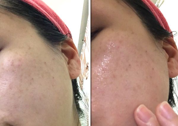 朵璽XIN NI SUNG激光瞬效美白精華