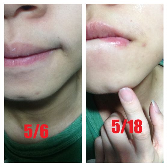 朵璽XIN NI SUNG激光瞬效美白精華