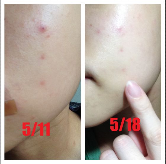 朵璽XIN NI SUNG激光瞬效美白精華