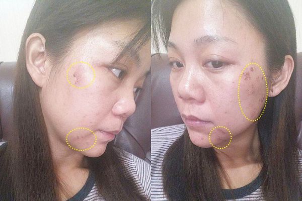 朵璽XIN NI SUNG激光瞬效美白精華