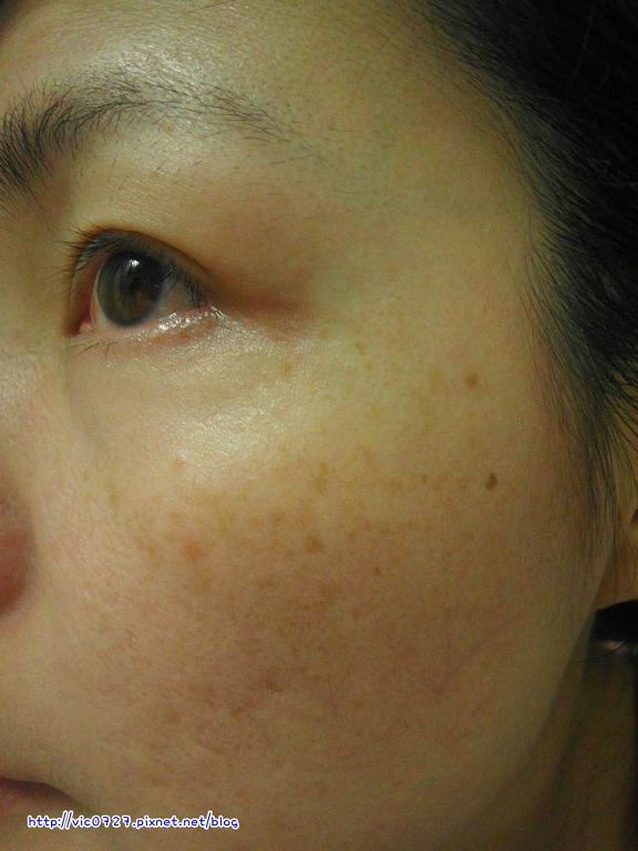 朵璽XIN NI SUNG激光瞬效美白精華