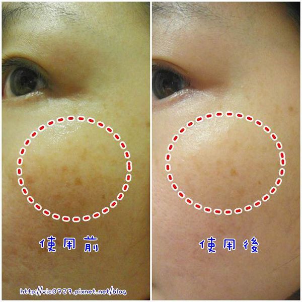 朵璽XIN NI SUNG激光瞬效美白精華