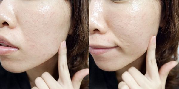 朵璽XIN NI SUNG激光瞬效美白精華