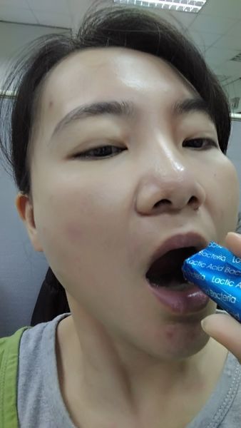 Angel LaLa天使娜拉 乳酸菌+乳果寡糖