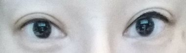 one eye done
