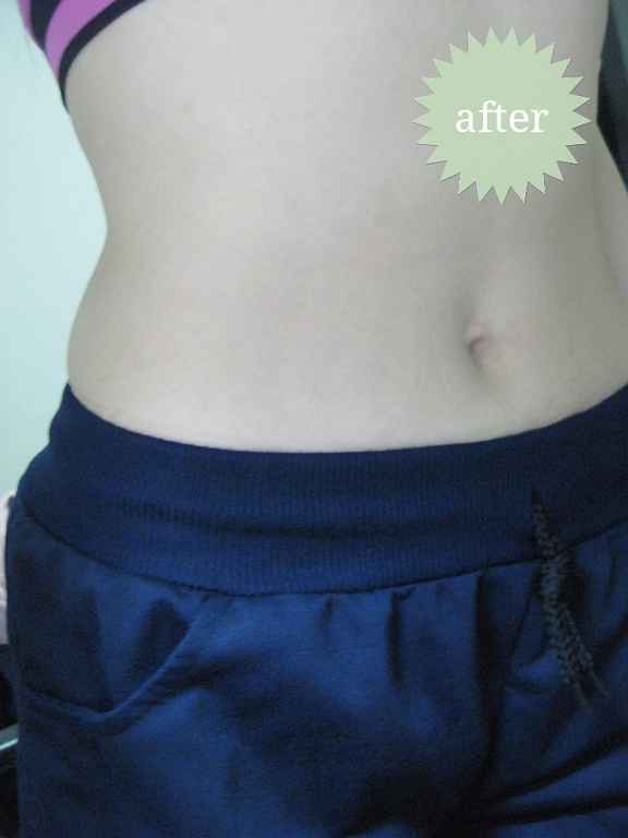 明奕蘆薈+木寡糖