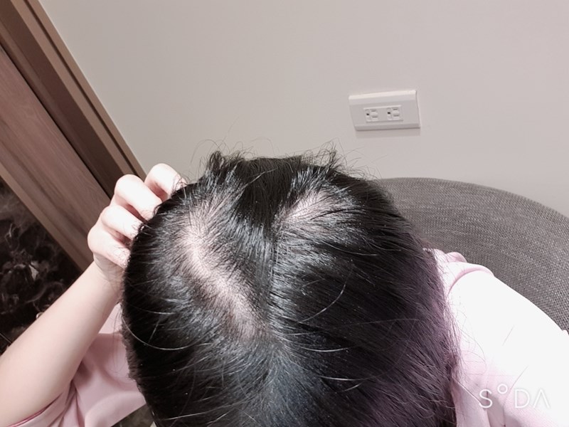 女人知己試用大隊、TOPPIK頂豐增髮纖維、天然角蛋白製成、靜電附著力百分