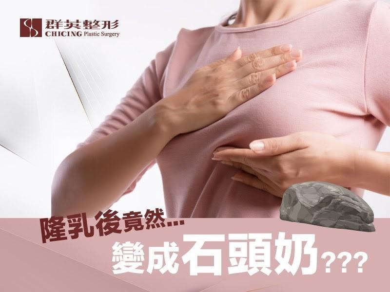 隆乳變成石頭奶?了解莢膜攣縮發生原因