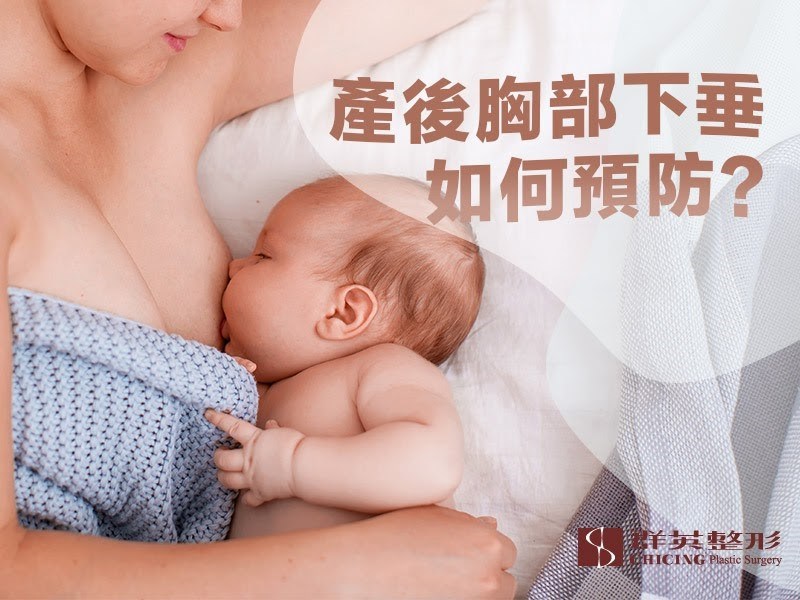 【高雄產後隆乳】預防產後胸部下垂,五大招教給你|姚勝發醫師