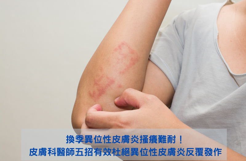 換季異位性皮膚炎搔癢難耐!皮膚科醫師五招有效杜絕異位性皮膚炎反覆發作