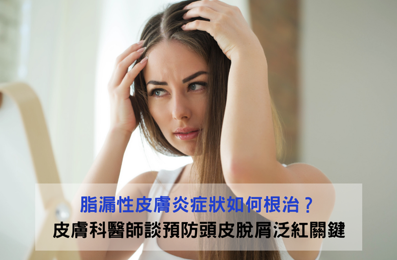 脂漏性皮膚炎症狀如何根治?專業皮膚科醫師說明頭皮脫屑泛紅的預防關鍵