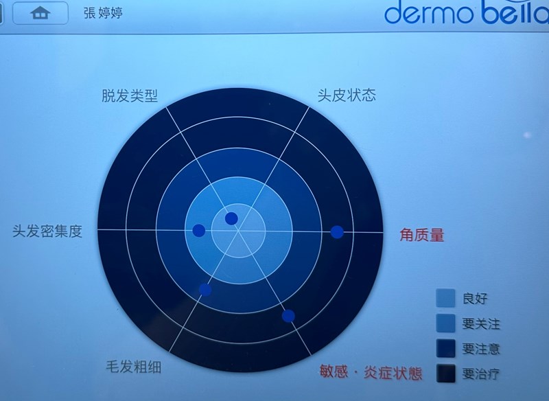 女人知己試用大隊,口碑行銷,部落客行銷,GaGa量身訂做診間科學專業頭皮檢測,gaga洗髮精,gaga水狀洗髮精,洗髮精,健康洗髮,洗髮精推薦,洗髮,護髮,養髮洗髮精,頭皮水,控油,強健髮根,養髮液,頭皮檢測,頭皮保養,頭皮養護,頭皮調理,清潔頭皮,強化滋養,活化髮根,豐盈,蓬鬆感