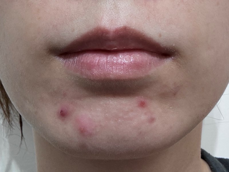 女人知己試用大隊,口碑行銷,部落客行銷,babywhite美白精華,babywhite精華評價,babywhite7大問題精華,配方有保濕基礎,吸收超快,開架保濕推薦,好用精華液,妝前保養推薦,台灣保養品推薦