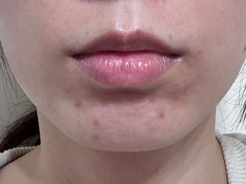 女人知己試用大隊,口碑行銷,部落客行銷,babywhite美白精華,babywhite精華評價,babywhite7大問題精華,配方有保濕基礎,吸收超快,開架保濕推薦,好用精華液,妝前保養推薦,台灣保養品推薦