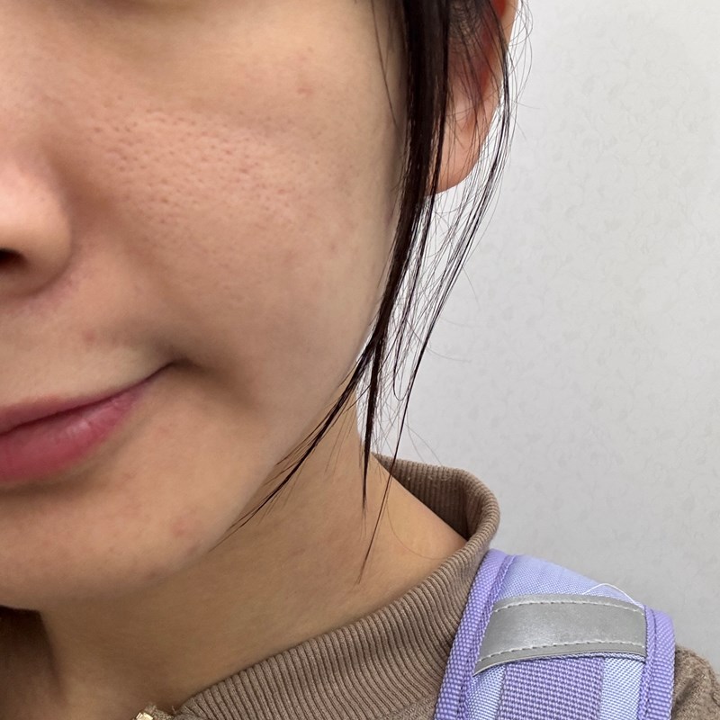 試用