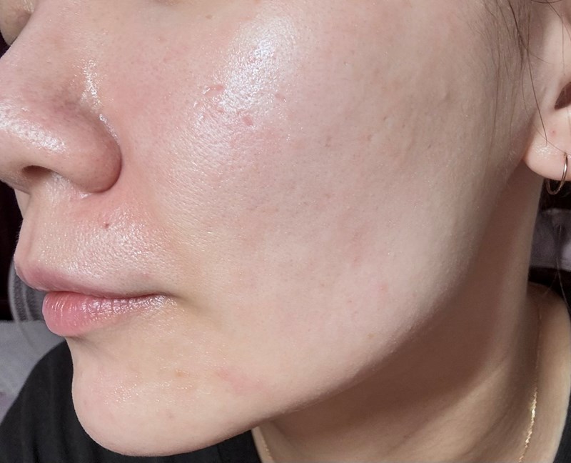 女人知己試用大隊,口碑行銷,部落客行銷,babywhite美白精華,babywhite精華評價,babywhite7大問題精華,配方有保濕基礎,吸收超快,開架保濕推薦,好用精華液,妝前保養推薦,台灣保養品推薦