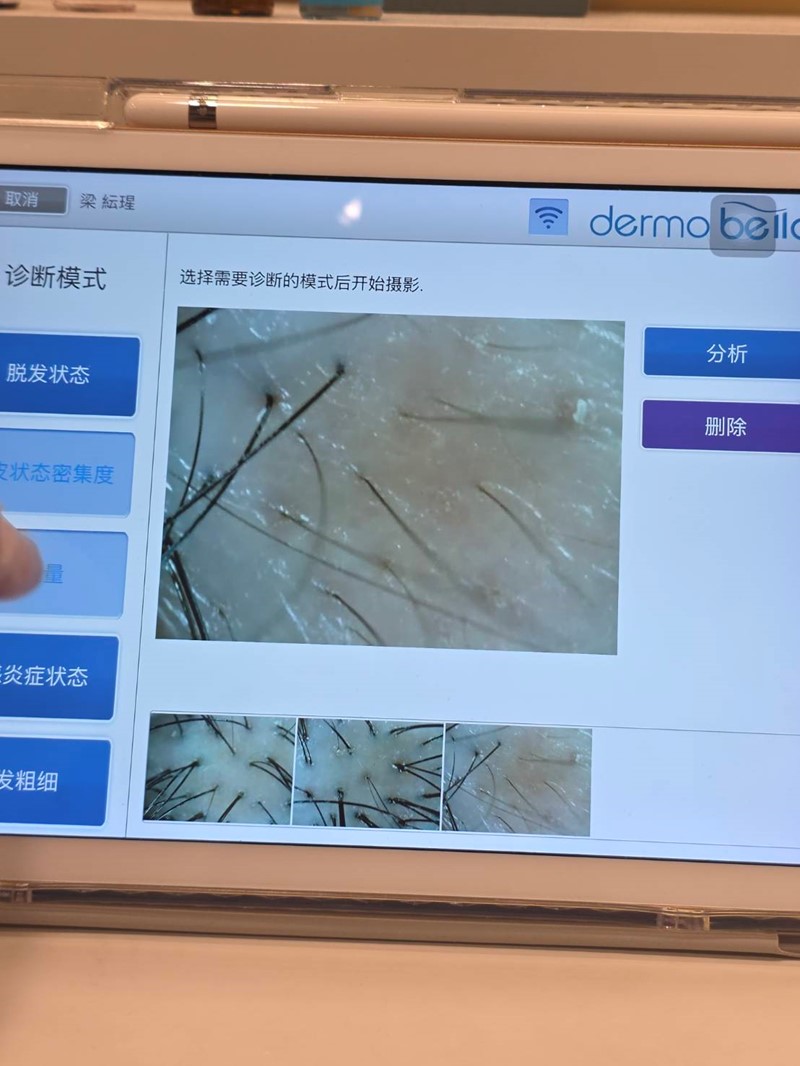 女人知己試用大隊,口碑行銷,部落客行銷,髮農生醫_健髮中心,髮農生醫,髮農健髮中心,外泌體,專業頭皮檢測,頭皮管理課程,頭皮檢測,女生掉髮怎麼辦,髮農生醫體驗心得,外泌體體驗心得