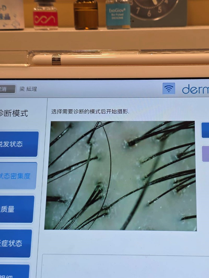 女人知己試用大隊,口碑行銷,部落客行銷,髮農生醫_健髮中心,髮農生醫,髮農健髮中心,外泌體,專業頭皮檢測,頭皮管理課程,頭皮檢測,女生掉髮怎麼辦,髮農生醫體驗心得,外泌體體驗心得