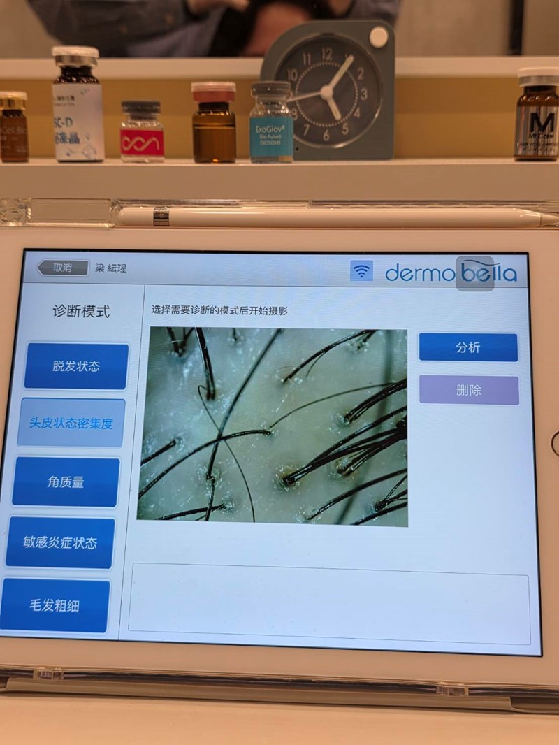 女人知己試用大隊,口碑行銷,部落客行銷,髮農生醫_健髮中心,髮農生醫,髮農健髮中心,外泌體,專業頭皮檢測,頭皮管理課程,頭皮檢測,女生掉髮怎麼辦,髮農生醫體驗心得,外泌體體驗心得