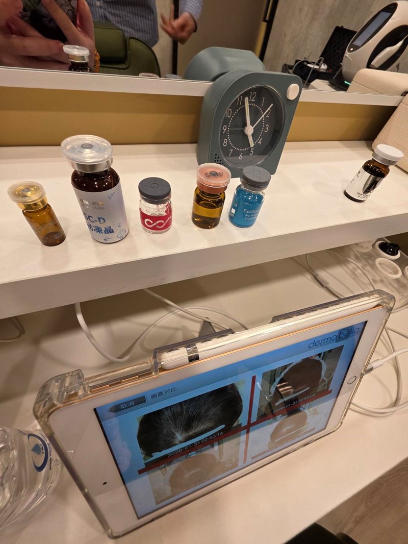 女人知己試用大隊,口碑行銷,部落客行銷,髮農生醫_健髮中心,髮農生醫,髮農健髮中心,外泌體,專業頭皮檢測,頭皮管理課程,頭皮檢測,女生掉髮怎麼辦,髮農生醫體驗心得,外泌體體驗心得
