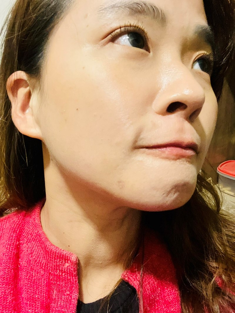 女人知己試用大隊,口碑行銷,部落客行銷,美怡雅時尚美學,彰化醫美,美怡雅時尚美學,每一秒都是你的高光時刻,美麗其實很簡單,賴政光醫師,高壓氧氣艙,醫學美容,雷射光療,抗老醫學,微整形,肉毒,玻尿酸,音波,腋下除毛,聚左旋乳酸,舒顏萃